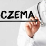 doctor writing eczema