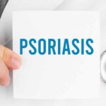 doctor holidng note that syas psoriasis